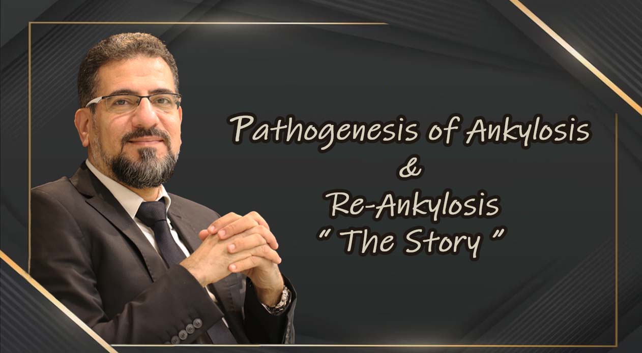 Pathogenesis of Ankylosis and Re-Ankylosis "The Story"